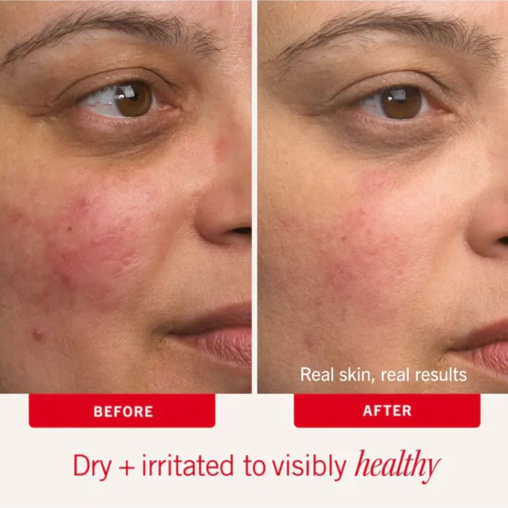 NEW First Aid Beauty Ultra Repair Cream Dry Sensitive Skin Moisturizer Treatment